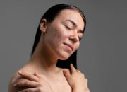 Tips Mengatasi Kulit Kering Saat Cuaca Dingin: Cara Mudah