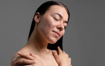 Tips Mengatasi Kulit Kering Saat Cuaca Dingin: Cara Mudah