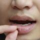 Cara Mengatasi Bibir Pecah-pecah Secara Alami dan Rahasia